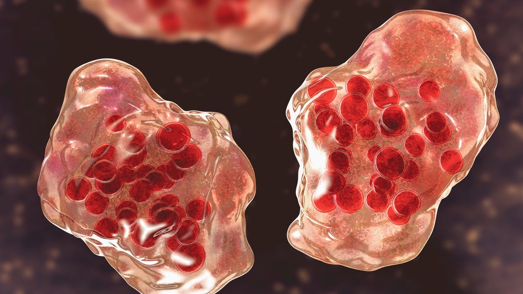 Central Minnesota county reports "several cases of suspected measles" — WCCO / CBS Minnesota, Wayzata Health news