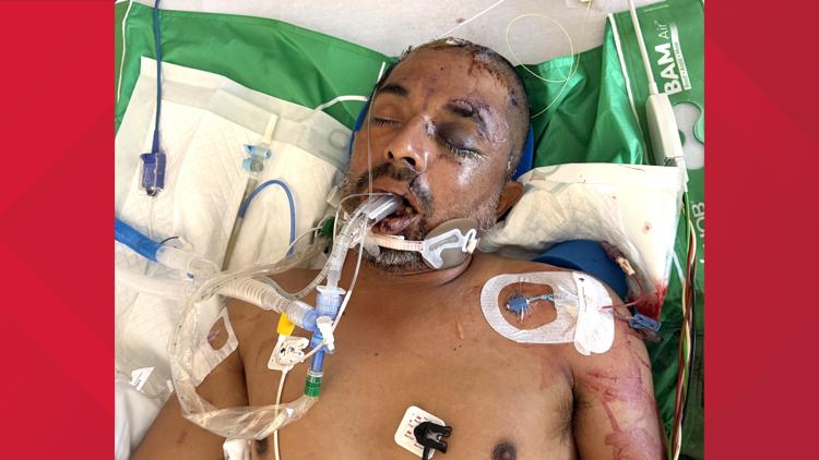 University Hospital asks for help identifying unconscious patient hit by truck Saturday evening — KENS 5 (San Antonio), Wayzata Health news