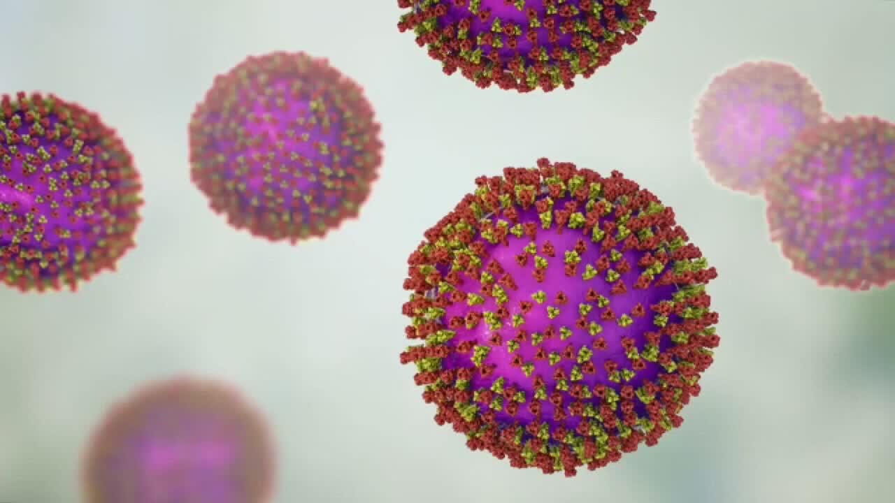 Wisconsin measles outbreak rises to 267 cases as spread continues — FOX 9, Wayzata Health news